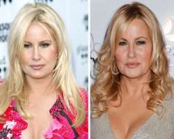 Jennifer Coolidge before surgery